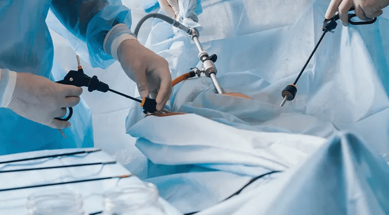 Laparoscopía avanzada